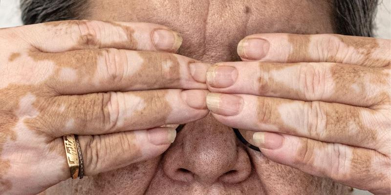 El Centro Residencial Sínodo 2005 de Cáritas Diocesana de Madrid acoge la exposición de fotografía '(In)Visibles'