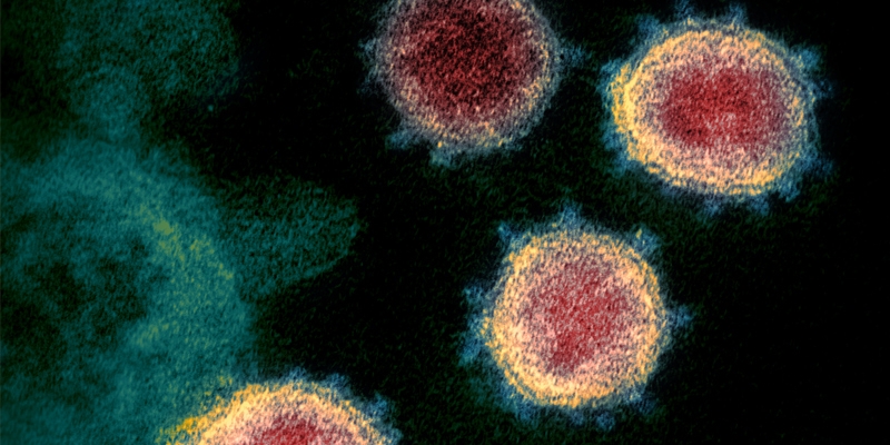 Congregaciones, hermandades y cofradías madrileñas inician una campaña solidaria a beneficio de los enfermos de coronavirus